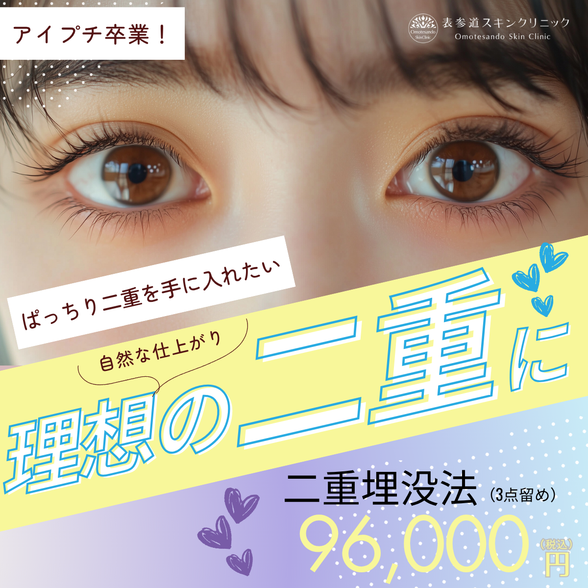 202506_二重埋没法